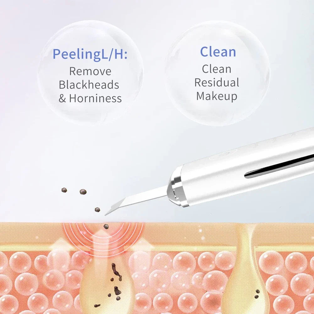 Electric Skin Scrubber Peeling Blackhead Remover Deep Face Cleaninger
