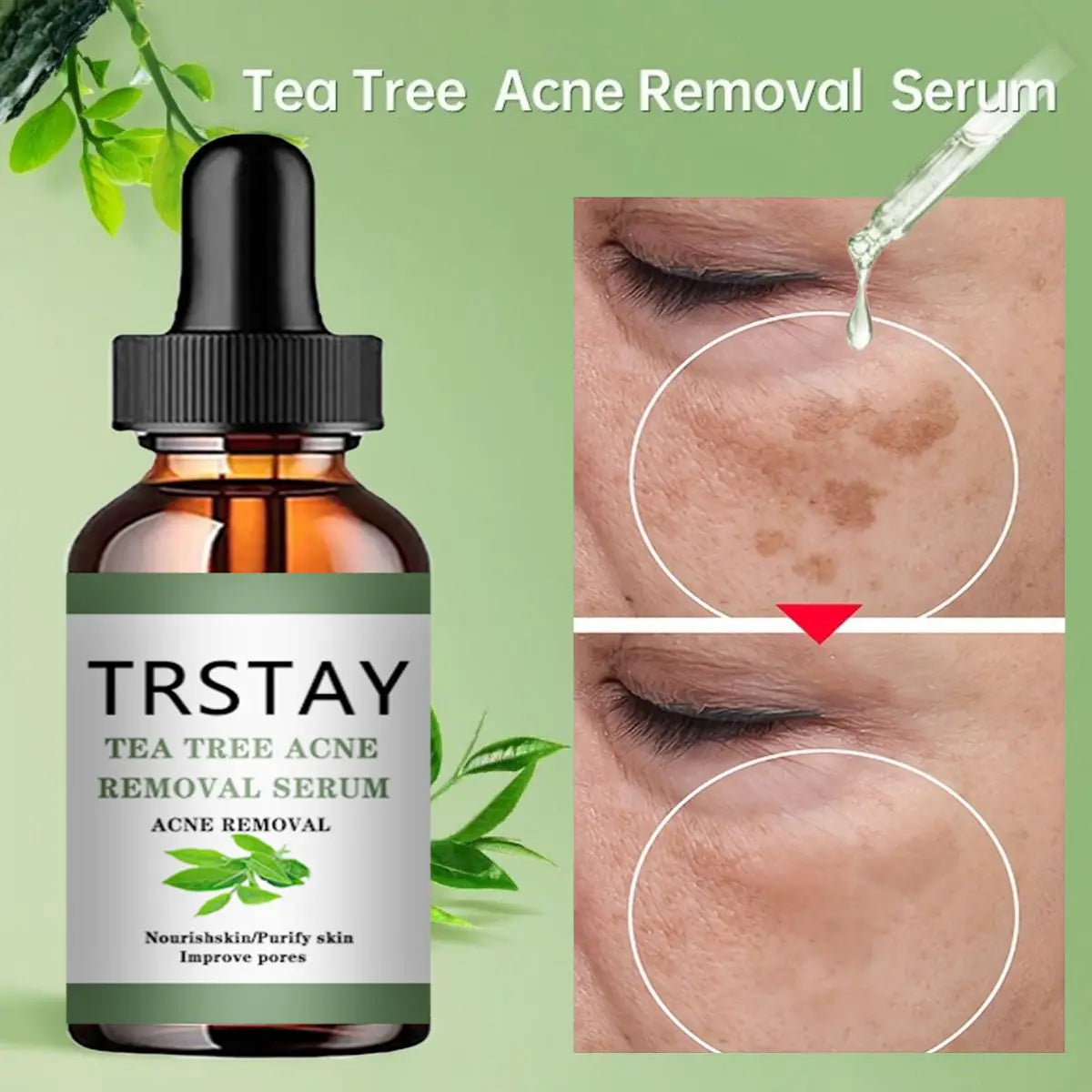 Acne Treatment Face Serum Tea Tree Oil Essence Moisturizing Shrink Pores Acne
