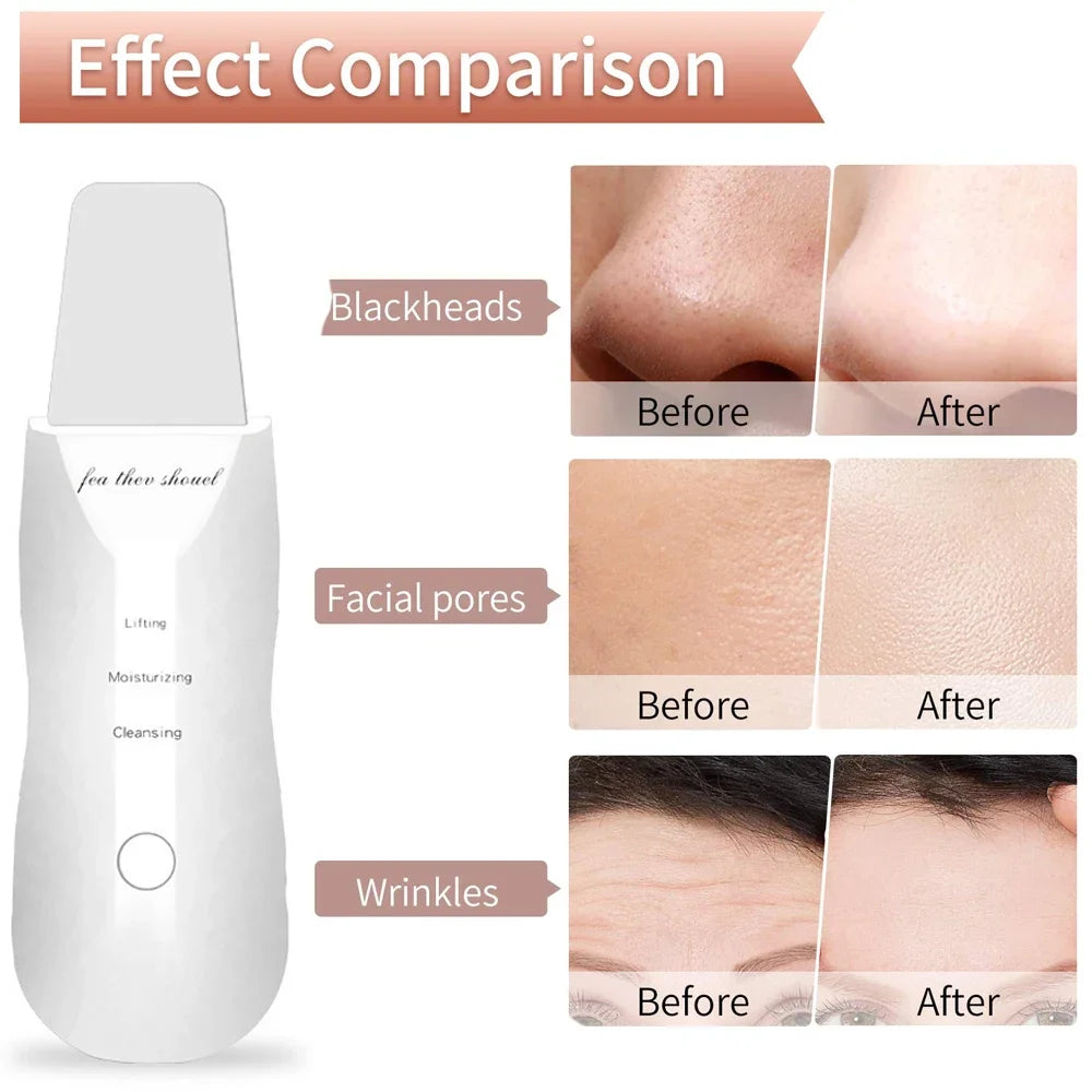Electric Skin Scrubber Peeling Blackhead Remover Deep Face Cleaninger
