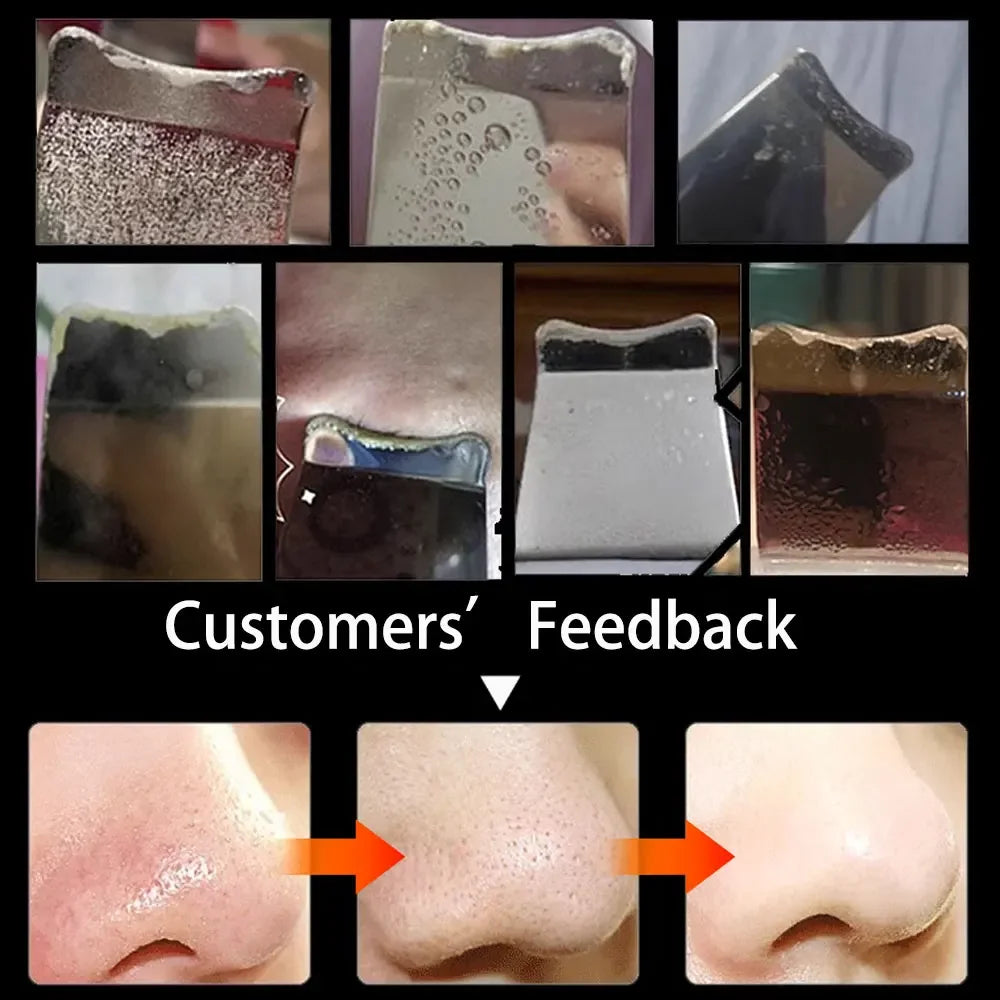 Electric Skin Scrubber Peeling Blackhead Remover Deep Face Cleaninger